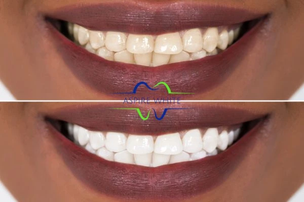Side-by-side comparison showing before and after results of a cosmetic treatment Lincoln