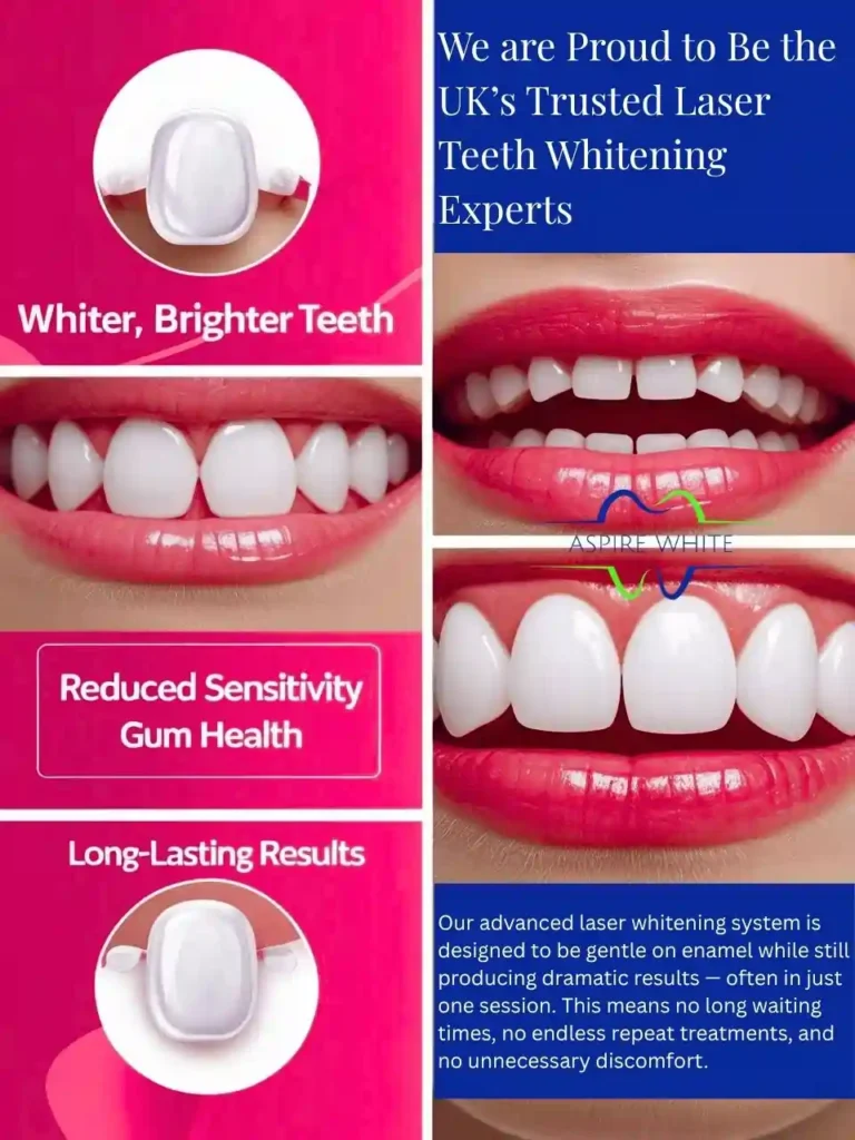 We are Proud to Be the UK’s Trusted Laser Teeth Whitening Experts Lincoln